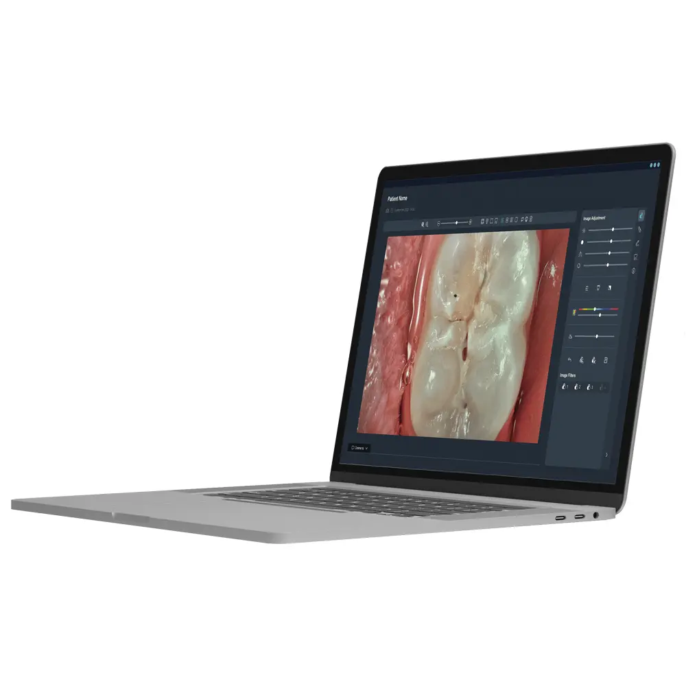 ACTEON® Imaging Suite